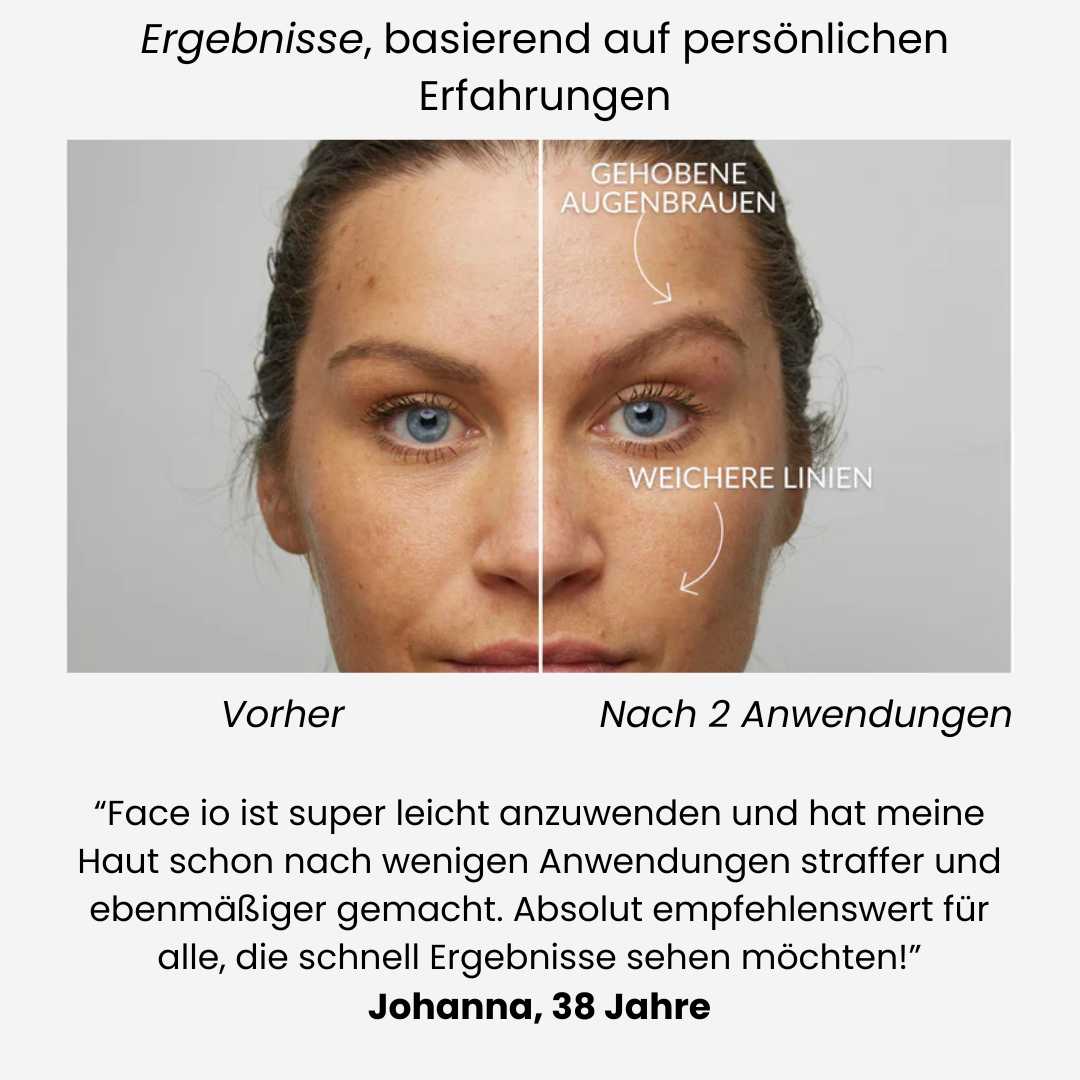 Face-iO Smoothing, firming, cleansing for radiant skin
